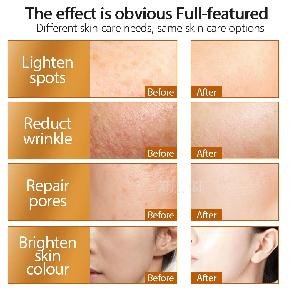 ZGTS 192pin Derma Roller Microneedle